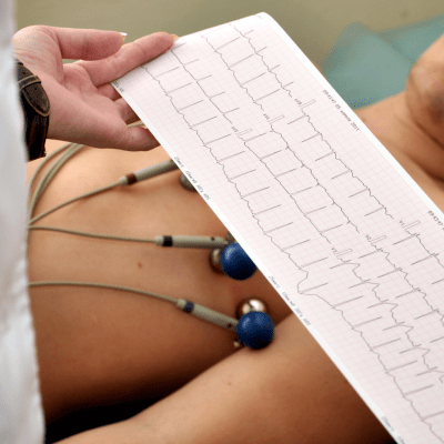 Cardiovascular Health